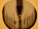 Doors - Wintertime Love X-RAY OF THE USSR X-RAY BONE RECORD