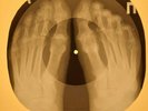 Simon and Garfunkel - Cecilia X-RAY OF USSR X-RAY BONE RECORD