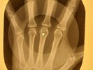 Beatles - In My Life X-RAY OF THE USSR X-RAY BONES RECORDING