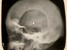 John Lenon - Imagine X-RAY OF THE USSR X-RAY BONES RECORDING