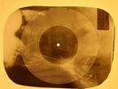 Beatles - She Said, She Said X-RAY OF USSR X-RAY BONES RECORDING