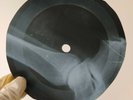 DAVID BOWIE ANCLE ARTHUR X-Ray USSR Record Roentgen Bones Ribs Music Vinyl