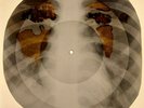 Elvis Presley - Just Because X-RAY OF THE USSR X-RAY BONES RECORD