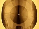 Doors - Hello, I Love You X-RAY OF THE USSR X-RAY BONE RECORDING