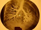Jerry Lee Lewis - Sticks And Stones X-RAY OF THE USSR X-RAY BONES RECORD