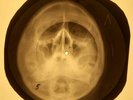 Doors - Ship of Fools X-RAY OF THE USSR X-RAY BONE RECORDING