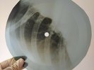 BEATLES GETTING BETTER X-Ray USSR Record Roentgen Bones Ribs Music Vinyl