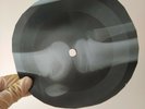 ROLLING STONES I'M WAITING X-Ray USSR Record Roentgen Bones Ribs Music Vinyl