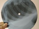 PINK FLOYD APPLES&ORANGES X-Ray USSR Record Roentgen Bones Ribs Music Vinyl