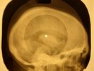Beatles - Honey Pie  X-RAY OF USSR X-RAY BONES RECORDING