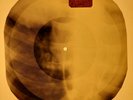 Beatles - I'm A Loser X-RAY OF USSR X-RAY BONES RECORDING