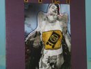 Tilt 'Til It Kills 1995 Fat Wreck Chords Vinyl LP FAT521-1