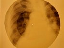 Beatles - Good Day Sunshine X-RAY OF THE USSR X-RAY BONES RECORDING