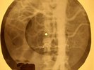 Doors - Hyacinth House X-RAY OF USSR X-RAY BONES RECORDING