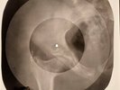 Doors - Strange Days X-RAY OF THE USSR X-RAY BONES RECORDING