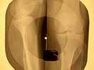 Ray Charles - Lonely Avenue X-RAY OF THE USSR X-RAY BONES RECORD