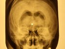 Chuck Berry - Tulane X-RAY OF THE USSR X-RAY BONES RECORDING