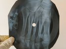 BEATLES YELLOW SUBMARINE X-Ray USSR Record Roentgen Bones Ribs Music Vinyl