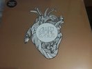 ALLEN STONE RADIUS VINYL **NEW**