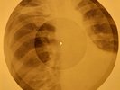John Lenon - Only People X-RAY OF THE USSR X-RAY BONES RECORD