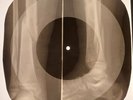 Elvis Presley - Love Me Tender X-RAY OF USSR X-RAY BONES RECORDS