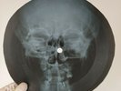 PINK FLOYD ASTRONOMY DOMINE X-Ray USSR Record Roentgen Ribs Bone  Music Vinyl