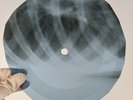 STOOGES LITTLE GIRL X-Ray USSR Record Roentgen Ribs Bones Music Vinyl