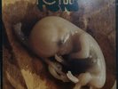 VINILE LP FRANCO BATTIATO - FETUS 33 GIRI ANNO 1972 STAMPA ITALY BBXL 10001