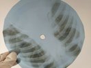 JOHNNY CASH NED CALLY X-Ray USSR Record Roentgen Bone Ribs Music Vinyl