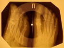 Elvis Presley - I Got Stung X-RAY OF USSR X-RAY BONES RECORD