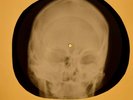 Beatles - Sun King X-RAY OF THE USSR X-RAY BONES RECORDS