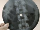 BEATLES WAIT X-Ray USSR Record Roentgen Bones Ribs Music Vinyl