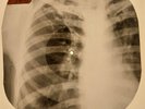 Johnny Cash - I Just Thought Youd Like To Know X-RAY OF USSR BONES RECORD
