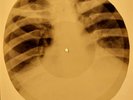 Doors - Love Her Madly X-RAY OF USSR X-RAY BONES RECORDING