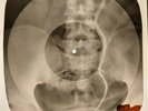 Rolling Stones - Monkey Man X-RAY OF THE USSR X-RAY BONES RECORD
