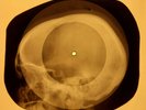 Doors - People Are Strange X-RAY OF THE USSR X-RAY BONE RECORDING