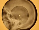 Ricky Nelson - Teenage Idol X-RAY OF THE USSR X-RAY BONE RECORD