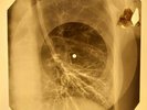 Beatles - Here Comes The Sun X-RAY OF THE USSR X-RAY BONES RECORDING