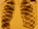 Doors - Spanish Caravan X-RAY OF USSR X-RAY BONE RECORD