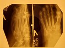 Johnny Cash - Big River X-RAY OF THE USSR X-RAY BONES RECORD