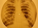 Beatles - Roll Oover Beethoven X-RAY OF USSR X-RAY BONES RECORDING