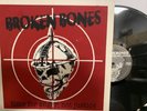 Broken Bones – Time For Anger, Not Justice LP 2008 Dr. Strange Records – DSR 108
