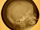Rolling Stones - You Better Move On X-RAY OF THE USSR X-RAY BONES RECORD