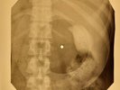 Rolling Stones - Singer Not The Song X-RAY OF USSR X-RAY BONES RECORD