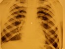 Beatles - I'm Only Sleeping X-RAY OF USSR X-RAY BONES RECORDING