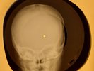 Rolling Stones - You Gotta Move X-RAY OF USSR X-RAY BONES RECORD