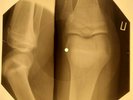 Beatles - Martha My Dear X-RAY OF THE USSR X-RAY BONES RECORDING