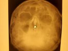 Elvis Presley - Fame And Fortune X-RAY OF THE USSR X-RAY BONES RECORDING