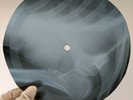 PINK FLOYD GNOME X-Ray USSR Record Roentgen Bones Ribs Music Vinyl