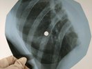 JOHNNY CASH NED CALLY X-Ray USSR Record Roentgen Bones Ribs Music Vinyl